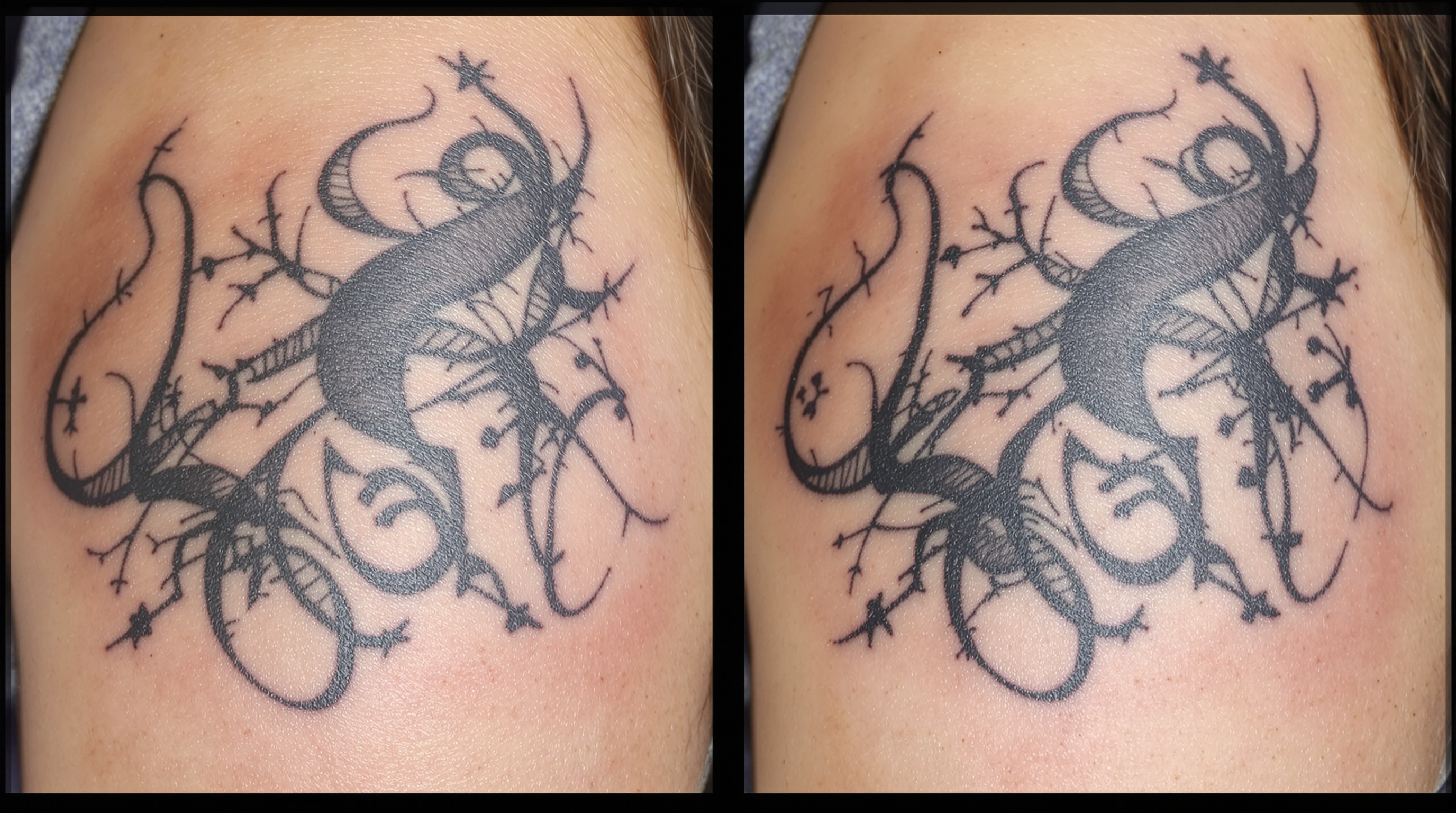 Résultat Hydrafacial chez DENISSA Esthétique